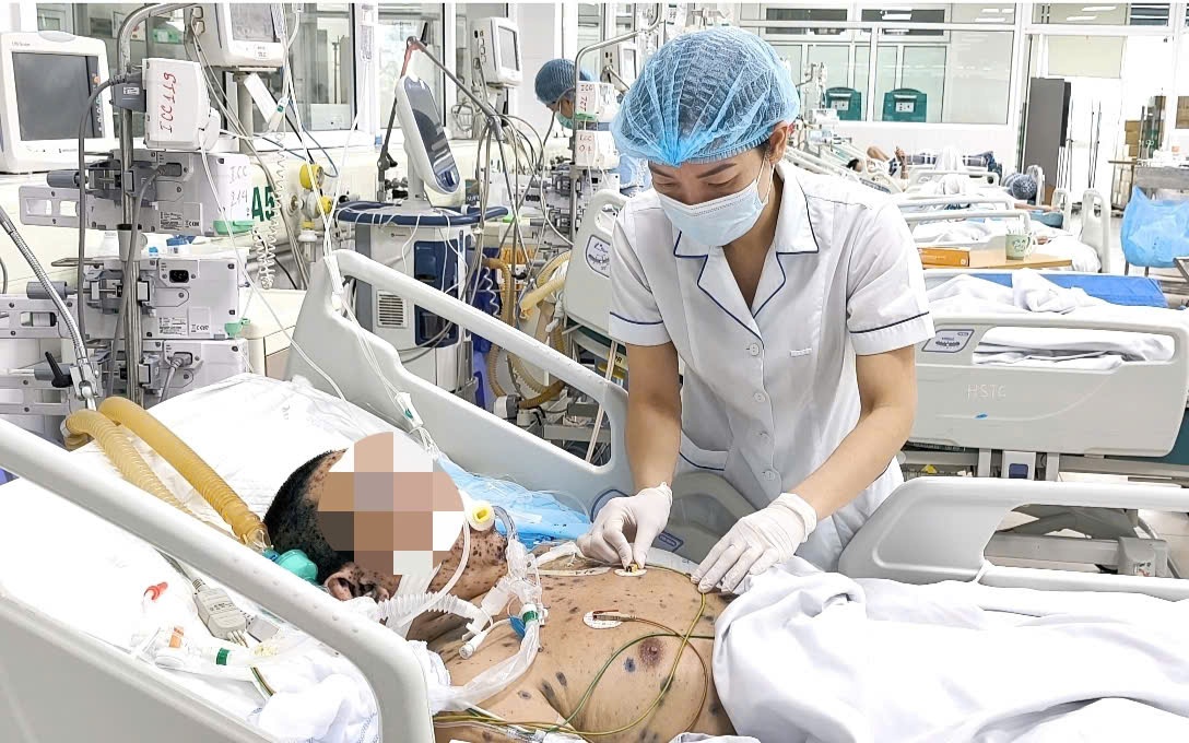 Ph&aacute;t hiện ổ dịch thủy đậu, một điểm trường cho học sinh nghỉ học - Ảnh 2.