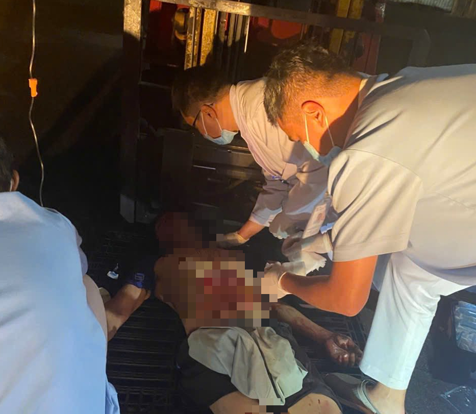 Một nam công nhân bị thủng bụng, lòi ruột vì tai nạn lao động - Ảnh 1.