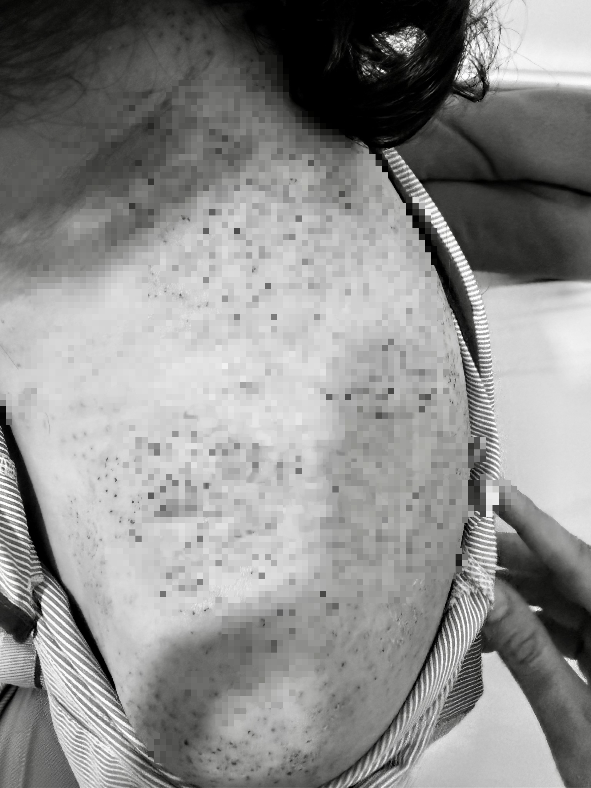 Người phụ nữ ở Vĩnh Long nhập viện cấp cứu sau khi chích lể, giác hơi - Ảnh 2.