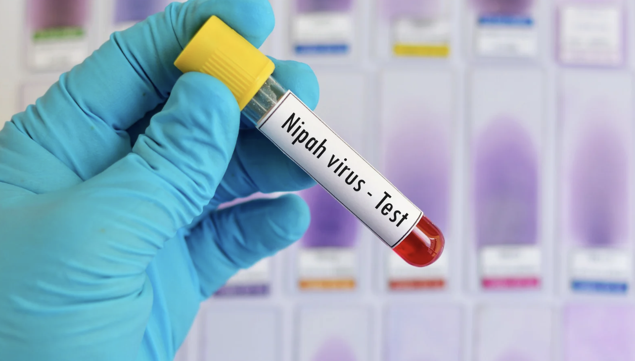 TPHCM kiểm soát dịch bệnh Nipah ra sao? - Ảnh 1.
