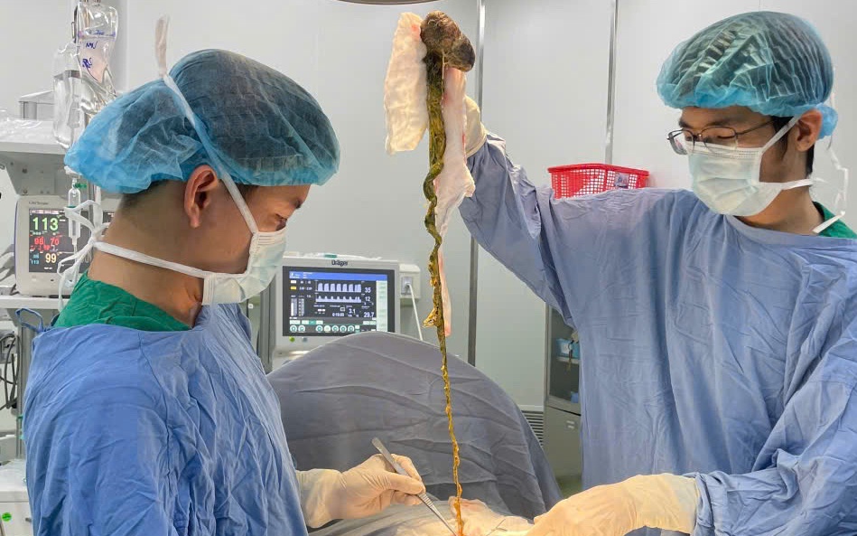 Bệnh nhân Campuchia mắc căn bệnh siêu hiếm trên thế giới được bác sĩ Việt Nam cứu chữa - Ảnh 3.