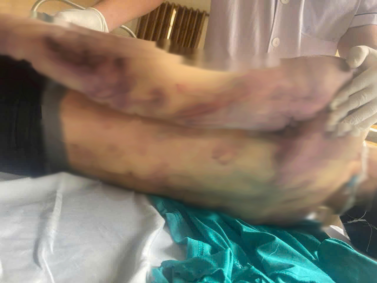 Mở rộng điều tra vụ học viên tử vong tại Trung tâm công tác xã hội Hải Hà - Ảnh 1.