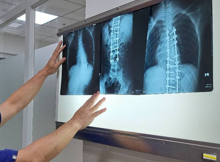Bộ Y tế đề nghị không căn cứ thời gian chụp X-quang để giám định BHYT - Ảnh 1.