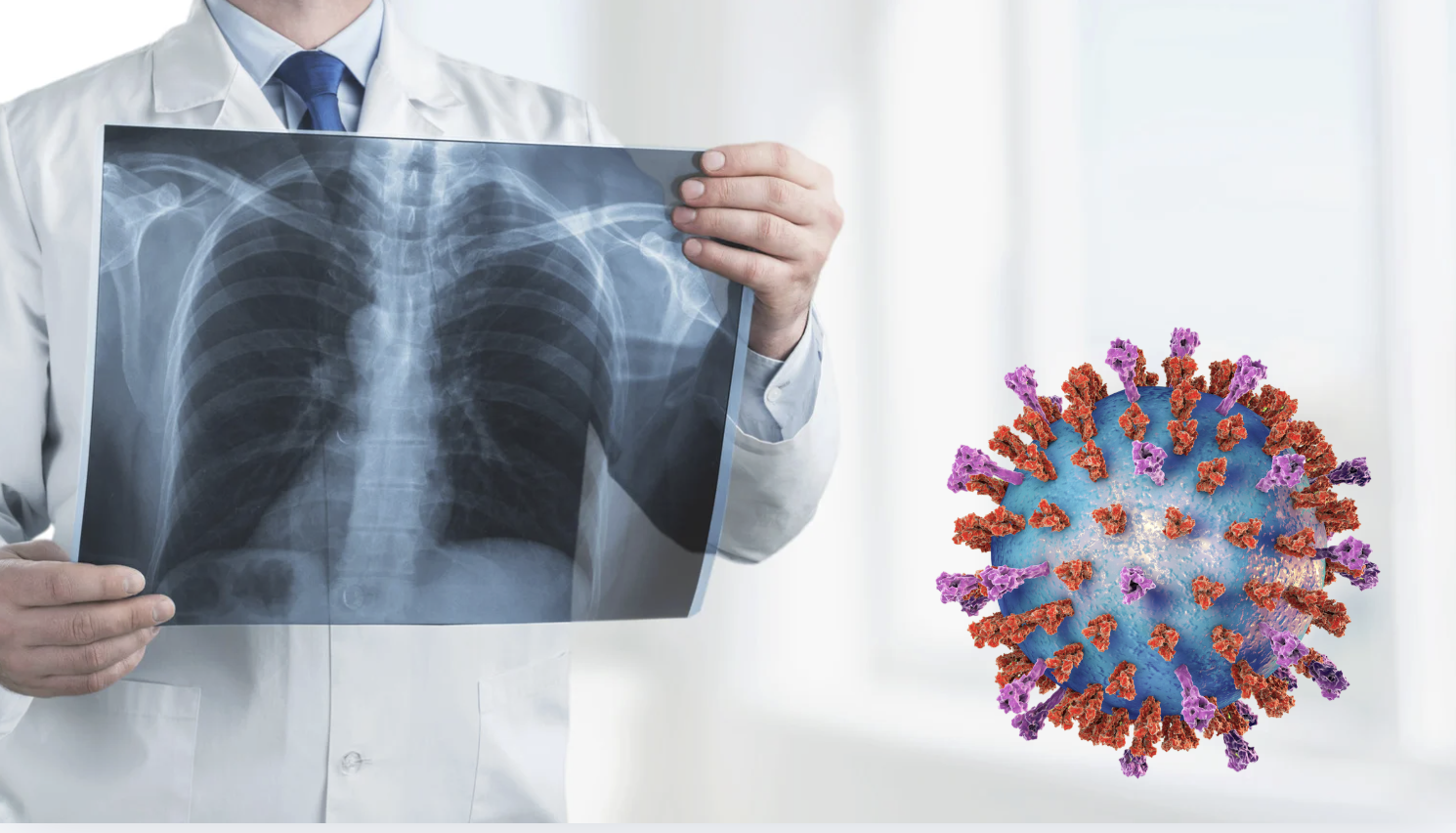 Đón Tết an toàn: Không chủ quan với bệnh viêm đường hô hấp cấp - Ảnh 1.