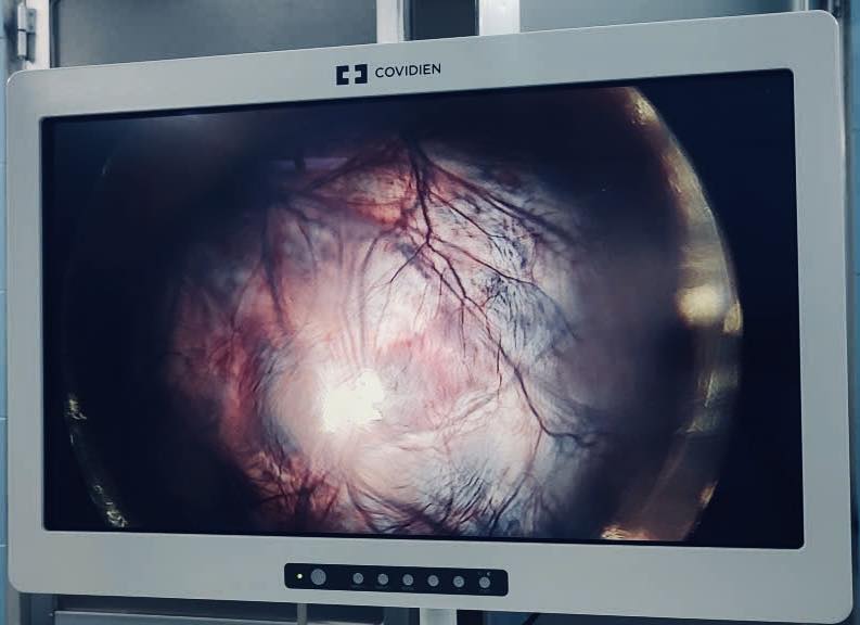 Niềm vui của bác sĩ giữ lại thiên chức làm mẹ cho bệnh nhân 22 tuổi - Ảnh 1.