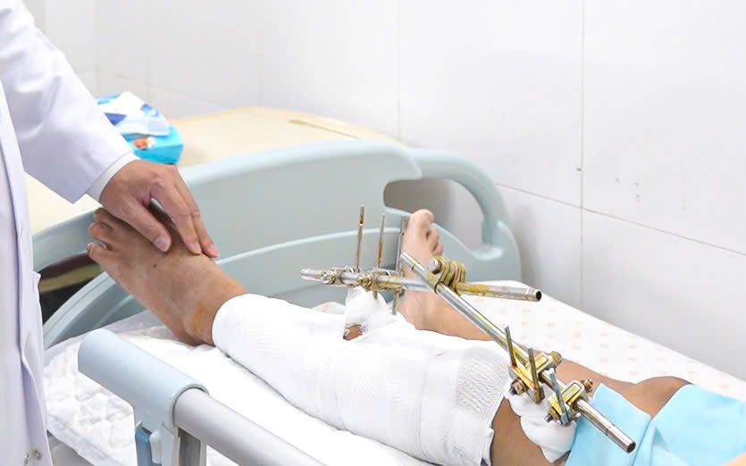 Cứu nam t&agrave;i xế c&ocirc;ng nghệ đa chấn thương nặng sau tai nạn tr&ecirc;n đường Phạm Ngũ L&atilde;o - Ảnh 3.