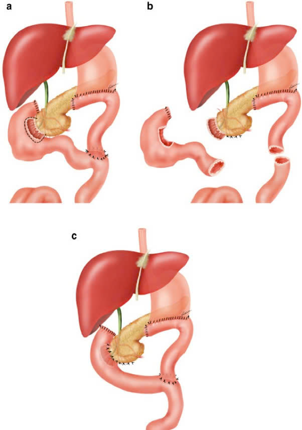 Bệnh nhân Campuchia mắc căn bệnh siêu hiếm trên thế giới được bác sĩ Việt Nam cứu chữa - Ảnh 1.
