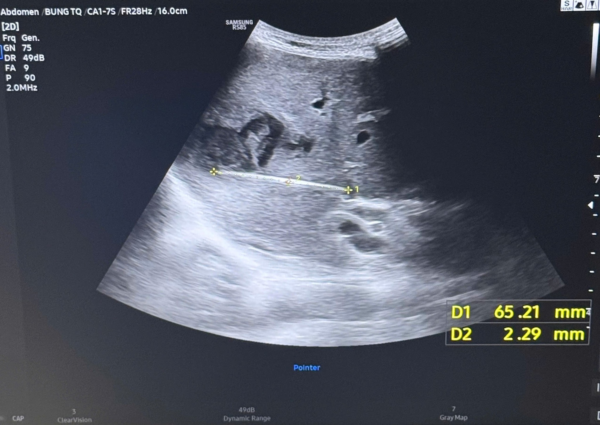 Bài học đắt giá từ thói quen ngậm tăm sau khi ăn - Ảnh 3.