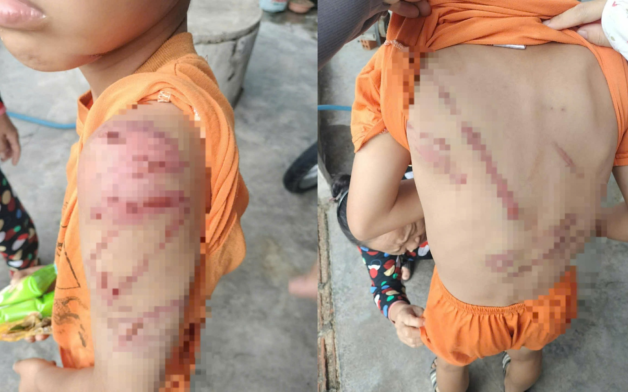 L&yacute; do người cha đ&aacute;nh con 10 tuổi bầm t&iacute;m khắp người - Ảnh 3.