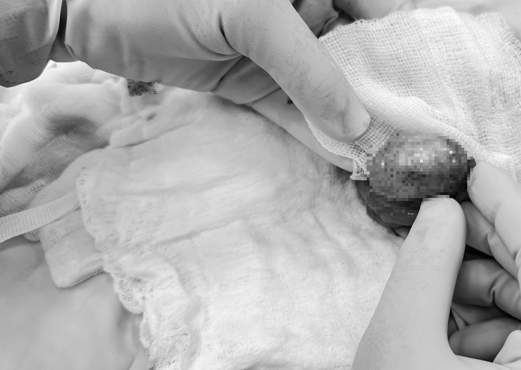 Chủ quan với cơn đau, nam sinh viên suýt phải cắt bỏ tinh hoàn - Ảnh 1.