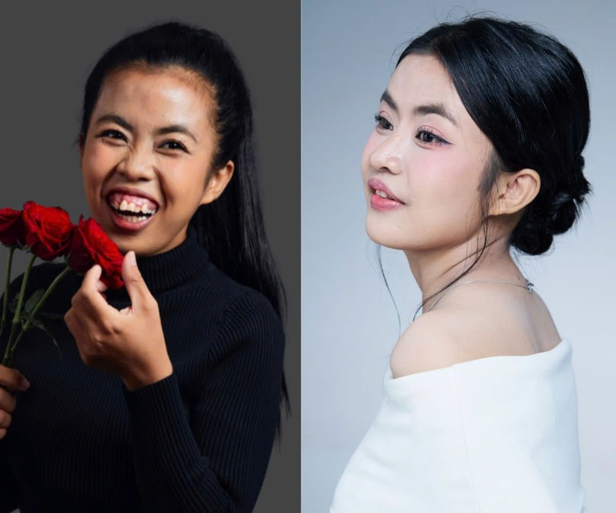 Đừng lạm dụng phẫu thuật thẩm mỹ! - Ảnh 2.