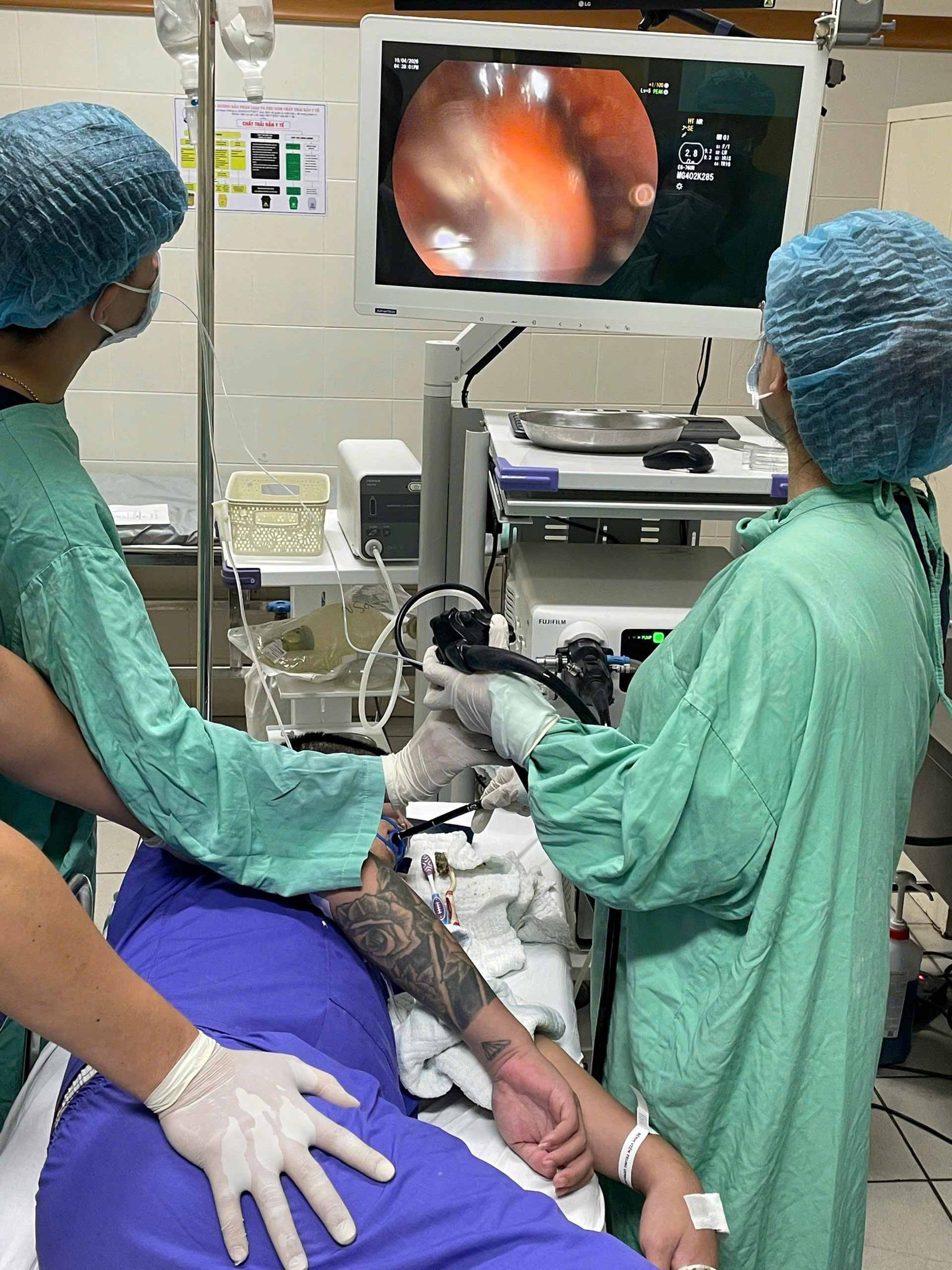 Người đàn ông nuốt cùng lúc 3 bàn chải đánh răng vào bụng - Ảnh 3.