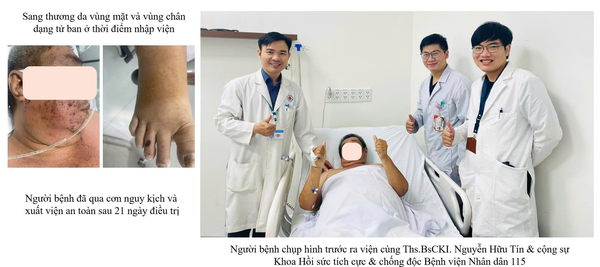 Ăn thịt lợn sống, người đ&agrave;n &ocirc;ng nguy kịch v&igrave; nhiễm khuẩn li&ecirc;n cầu lợn - Ảnh 1.