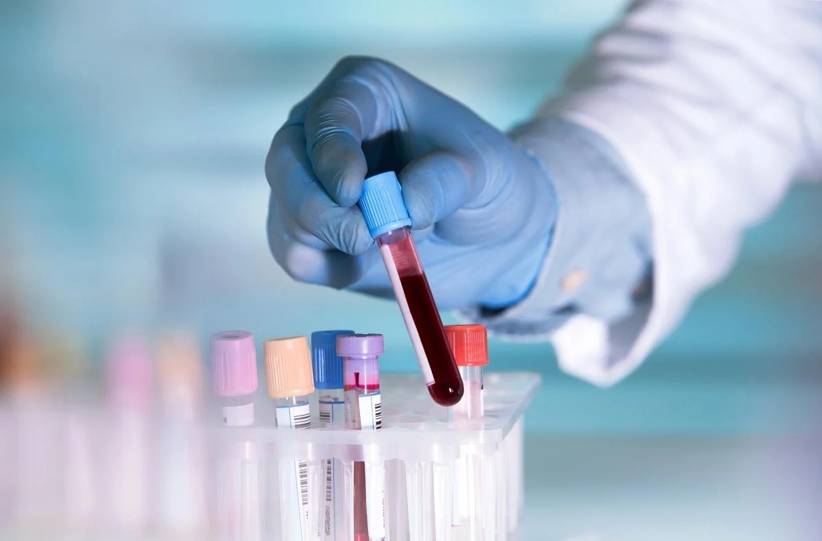  Mỹ phát triển xét nghiệm ung thư giá rẻ - Ảnh 1.