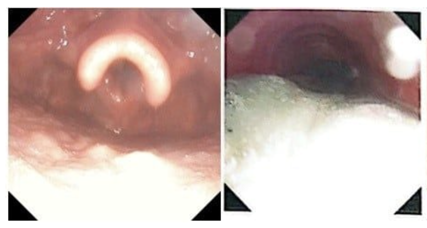 Ngạt khói nặng sau vụ cháy, đôi vợ chồng trẻ được hồi sinh kỳ diệu  - Ảnh 2.