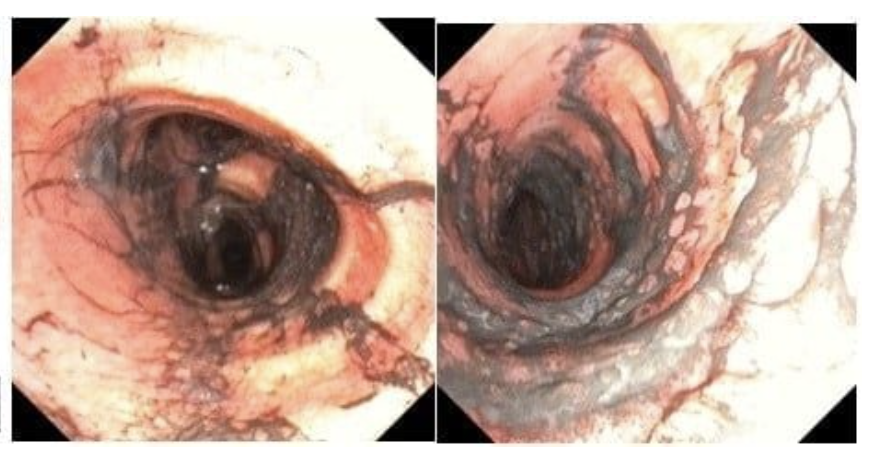 Ngạt khói nặng sau vụ cháy, đôi vợ chồng trẻ được hồi sinh kỳ diệu  - Ảnh 1.