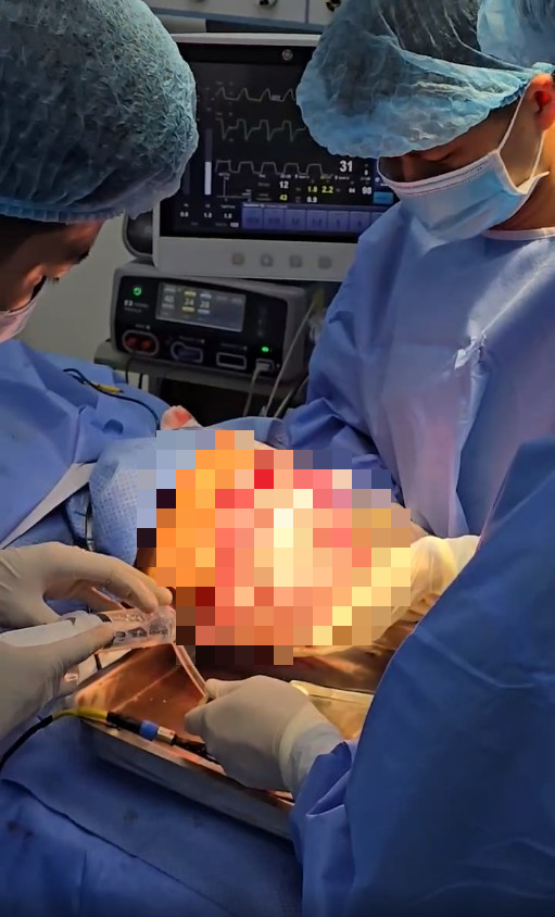 Tai nạn lao động nghi&ecirc;m trọng: C&ocirc; g&aacute;i 26 tuổi bị lột da đầu v&igrave; m&aacute;y tuốt l&uacute;a - Ảnh 1.