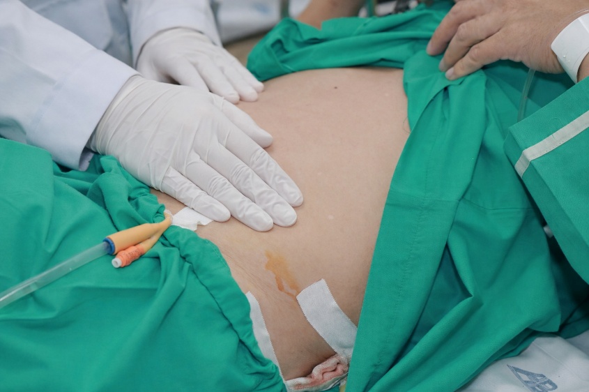 Người đàn ông cấp cứu vì tin vào “thuốc tan sỏi” trên mạng - Ảnh 3.