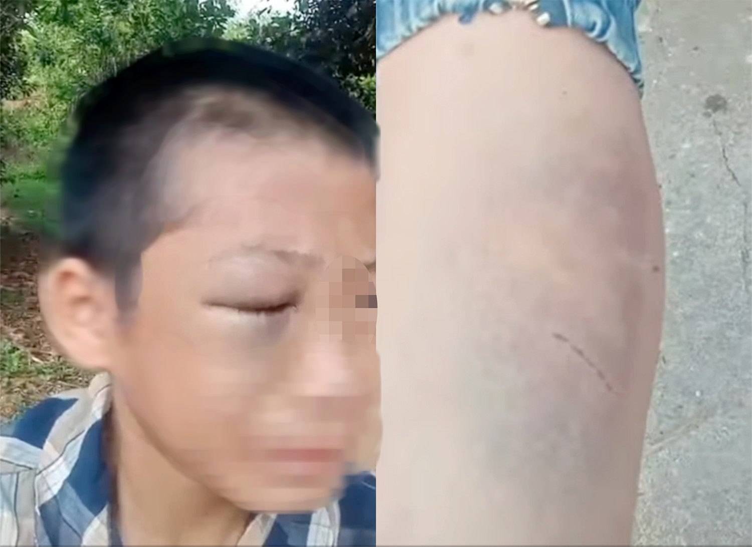 Clip bé trai mắt bầm tím, khóc kêu cứu vì nhiều lần bị người thân đánh đập - Ảnh 1.