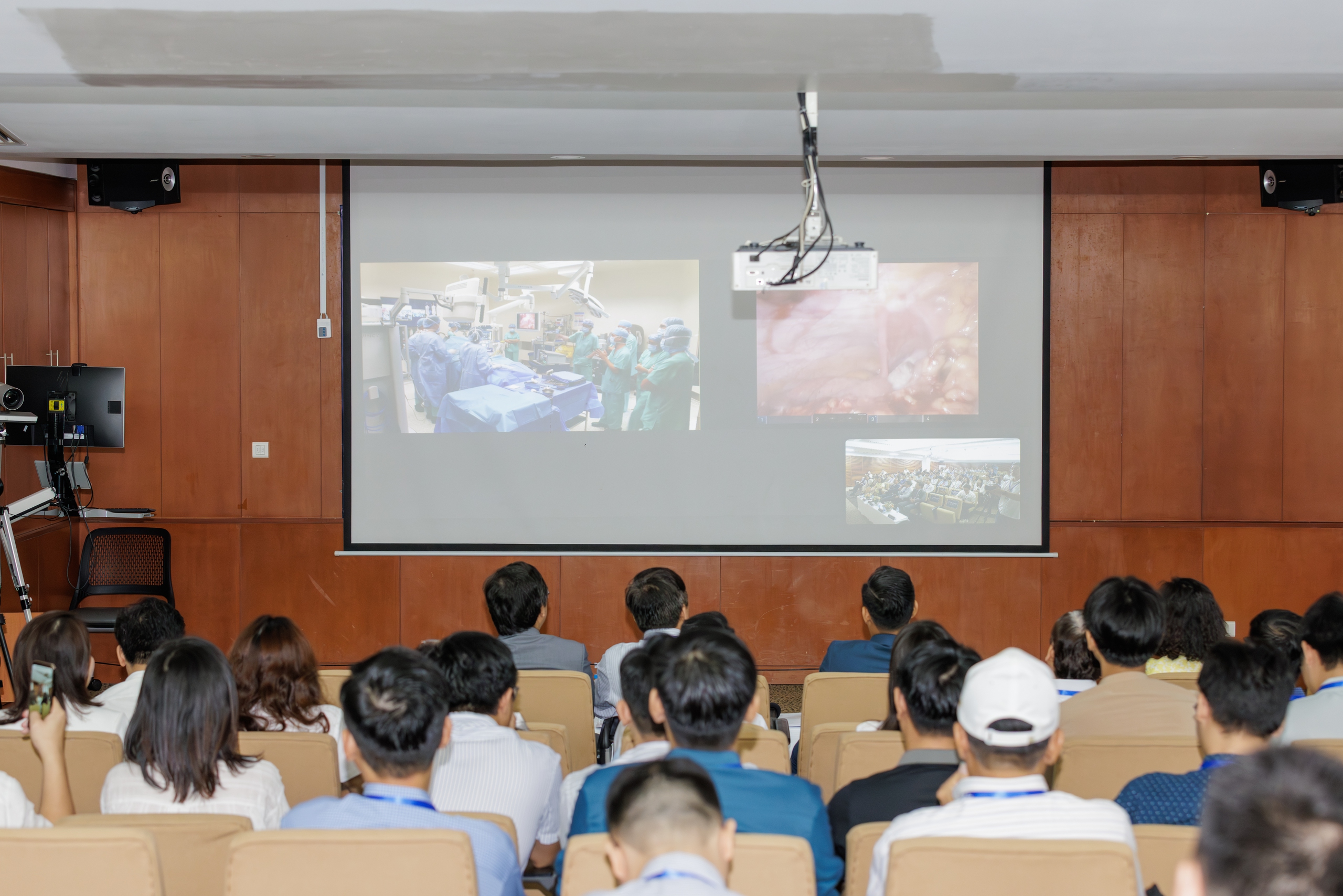AI và robot giúp bác sĩ xử lý ca ung thư dạ dày phức tạp - Ảnh 2.