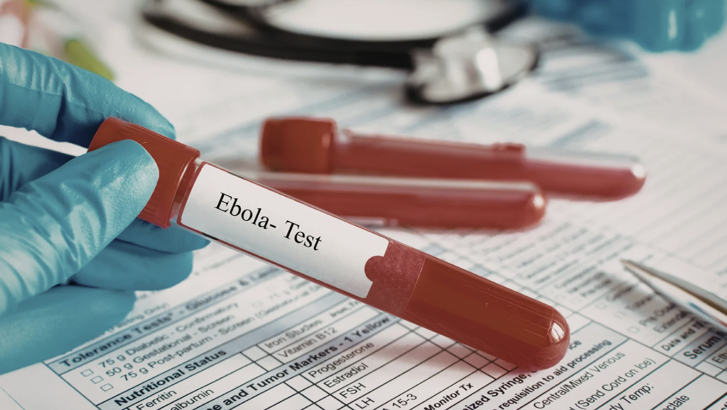 TPHCM tăng cường giám sát cửa khẩu, chủ động phòng nguy cơ dịch Ebola xâm nhập - Ảnh 1.