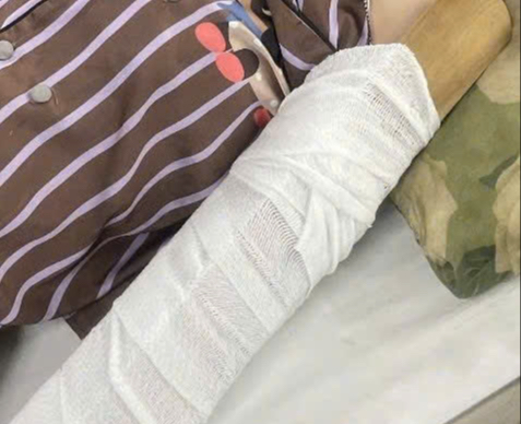 Kinh hoàng cô gái bị máy ép nước mía cuốn xoay nhiều vòng - Ảnh 1.