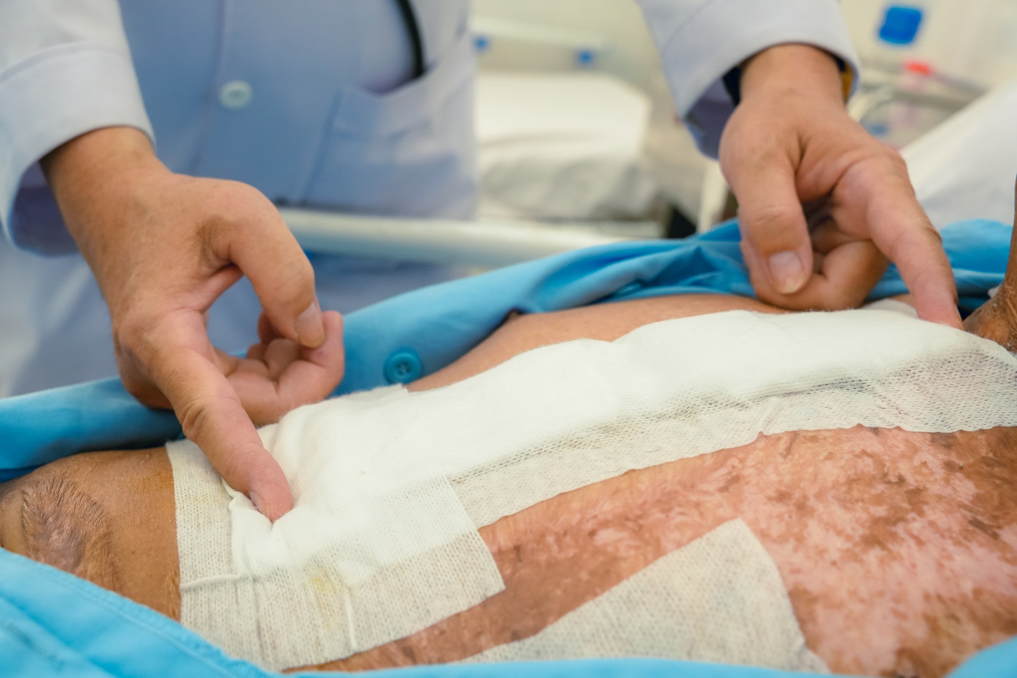 Cứu sống nam thanh niên 38 tuổi bị thủng tim nguy kịch ở TPHCM - Ảnh 2.