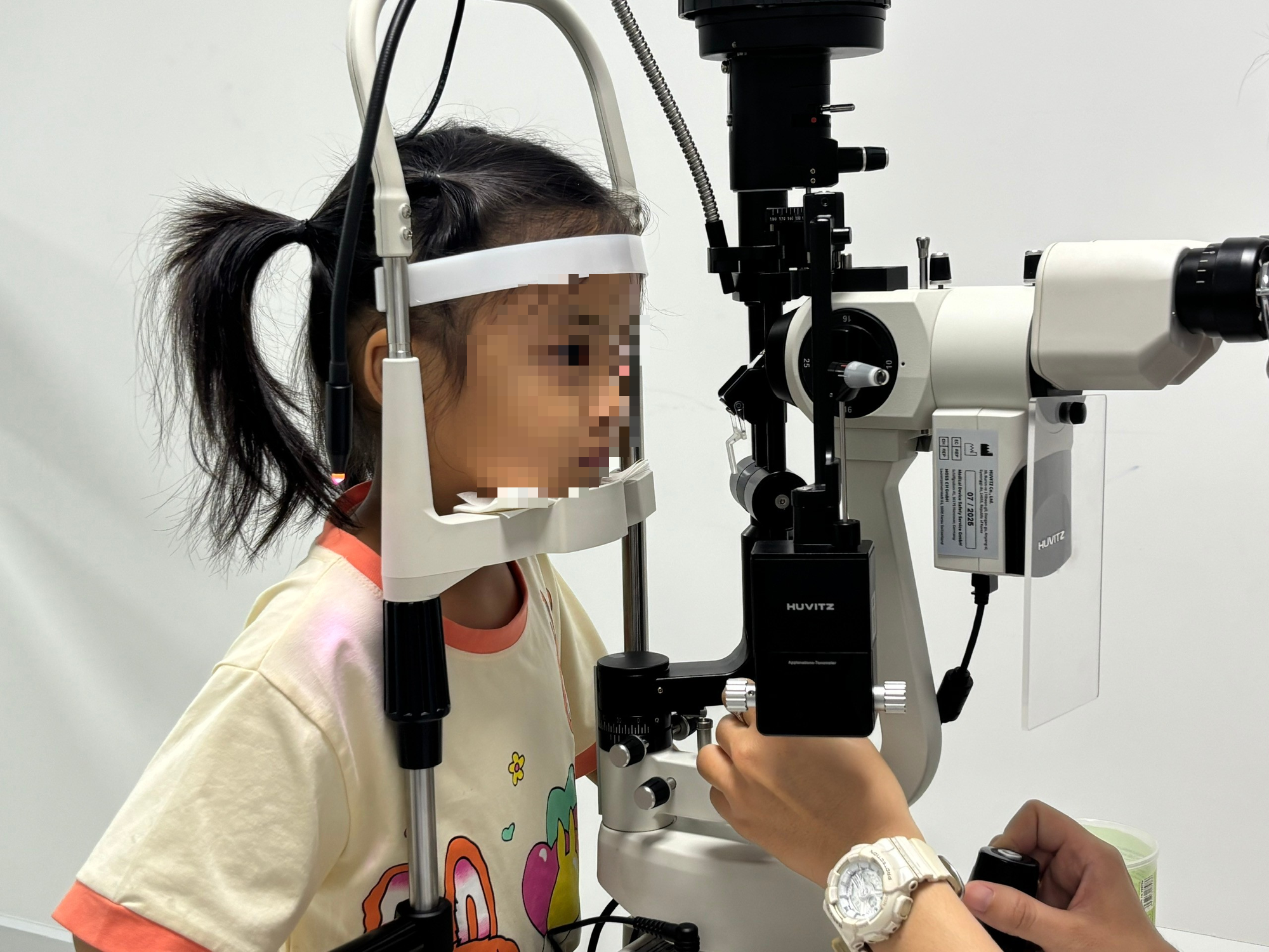 Điều trị thành công nhiều trẻ bị lác mắt - Ảnh 1.