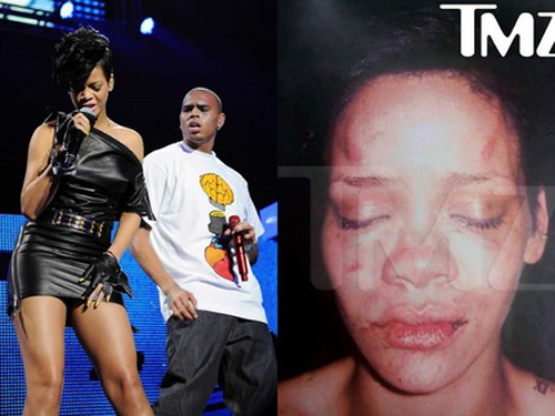 Bị bạo hành tàn nhẫn, Rihanna vẫn còn yêu bồ cũ