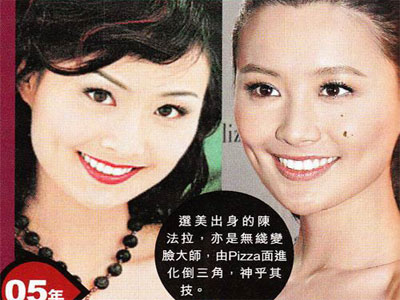 Hé lộ bí mật dàn sao hot của TVB đã "dao kéo"