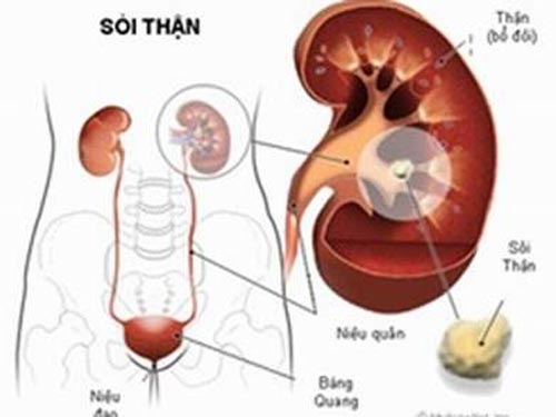 Hiện tượng thừa vitamin Hiện tượng thừa vitamin