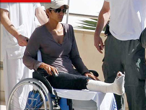 “Miêu nữ” Halle Berry gãy một chân