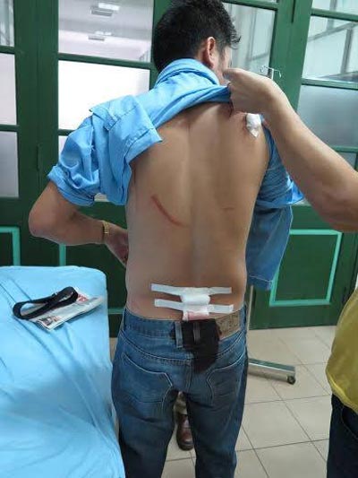 Nhà báo Nguyễn Ngọc Quang và những  vết thương trên cơ thể