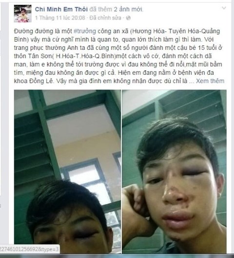 
Câu chuyện Phú bị đánh được chia sẻ trên mạng xã hội gây xôn xao dư luận mấy ngày qua (Ảnh: Chụp lại từ màn hình).
