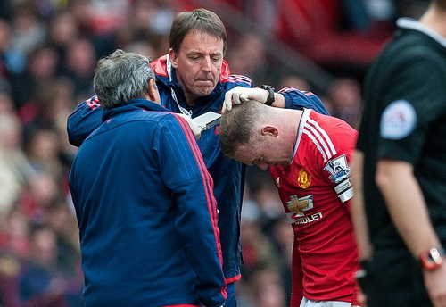 
Rooney đổ máu sau pha va chạm với Kompany
