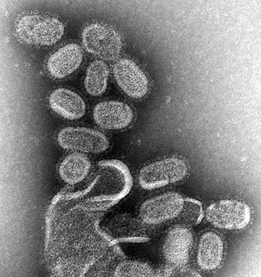 Virus cúm qua kính hiển vi điện tử Ảnh: MEDICAL XPRESS
