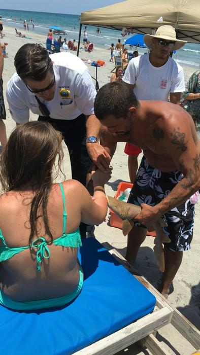 
Con cá mập cắn rồi nhất quyết không chịu nhả tay người phụ nữ. Ảnh: Courtesy Boca Raton Fire Rescue
