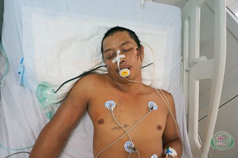 
Nạn nhân có hình xăm trên ngực - Ảnh do Bệnh viện Đa khoa Nghệ An cung cấp
