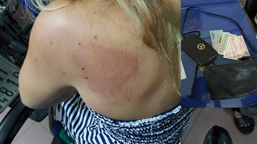 Một nữ du khách người Anh bị hai phụ nữ Việt kéo lê cướp túi xách