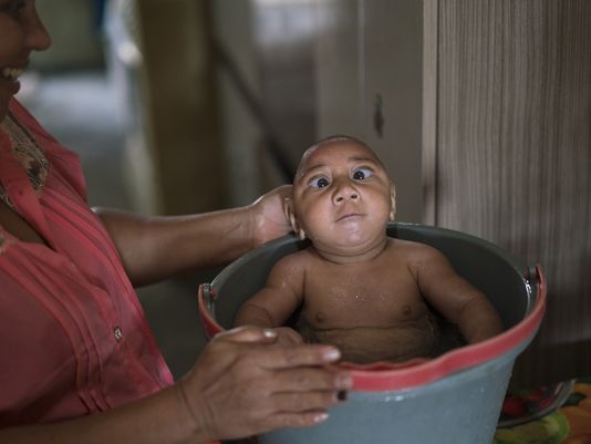 
Virus Zika dẫn đến các trường hợp dị tật đầu nhỏ ở trẻ sơ sinh. Ảnh: AP
