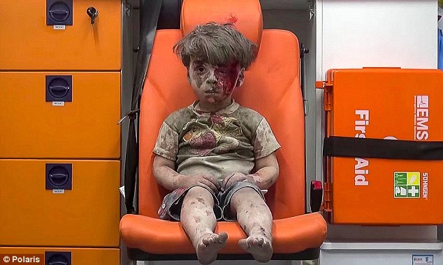 
Chỉ trong vòng chưa đầy 24 giờ, hai hình ảnh cho thấy sự tàn khốc nhất của cuộc chiến Syria nổi lên trên báo chí thế giới. Trong ảnh này là cậu bé Omran Daqneesh thất thần trên chiếc ghế cam khiến cả thế giới động lòng. Bé là 1 trong 5 đứa trẻ bị thương trong cuộc không kích ngày 17-8 ở Aleppo. Ảnh: Daily Mail

