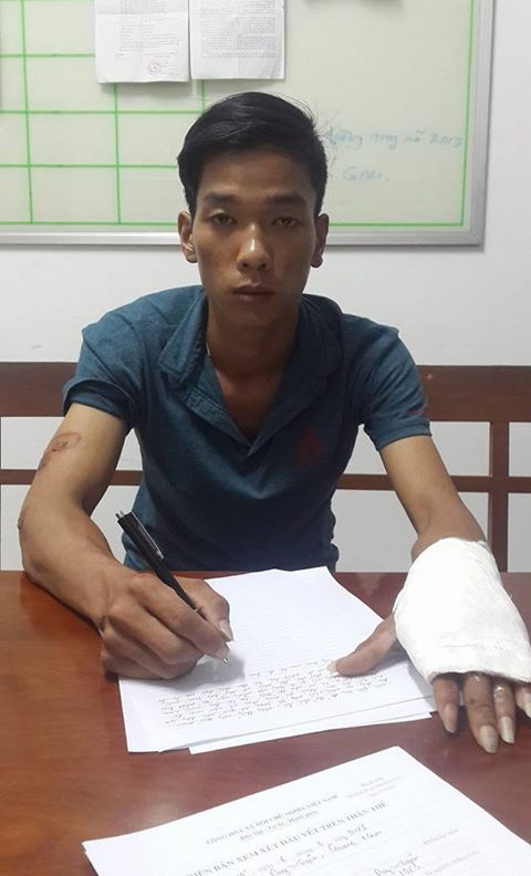 
Hành vi bỏ trốn sau khi gây tai nạn của Nguyễn Ngọc Trọng rất đáng lên án
