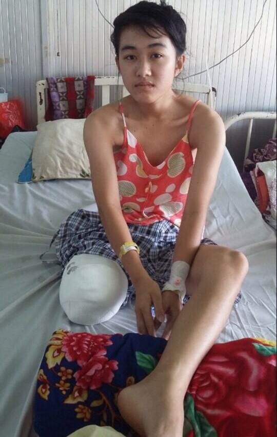 
Nữ sinh Lê Thị Hà Vi bị cưa chân vì bác sĩ tắc trách

