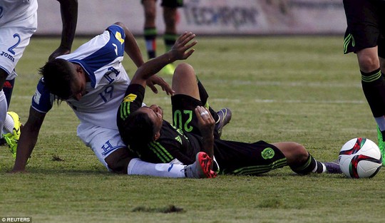
Luis Garrido gãy gập chân sau cú đè của đối thủ
