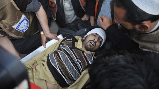 
Người dân bị thương sau vụ đánh bom tự sát ở Mardan, Pakistan. Ảnh: Alamy
