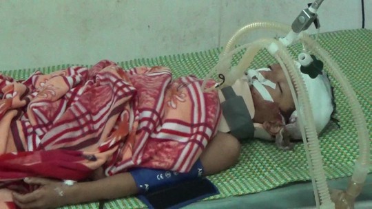 
Sau khi bị bác đánh, cháu Nguyễn Ngọc Chiến bị chấn thương sọ não, đang nằm điều trị tại BV Sản nhi Nghệ An - Ảnh: Đô Lương
