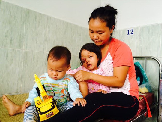 Mẹ con bé H’Tuyết KSơr lúc mới nhập viện ở Bệnh viện Mắt TP HCM