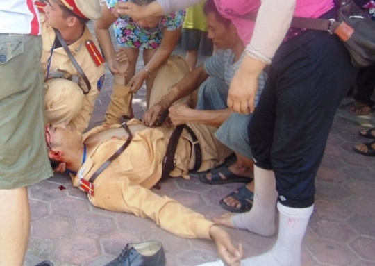 Một CSGT tỉnh Thanh Hóa bị đối tượng vi phạm lao xe vào gây thương tích nặng Ảnh: THANH TUẤN
