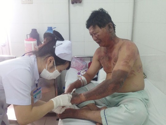 
Anh Mai Xuân Long đang được nhân viên y tế chăm sóc vết bỏng do cháy xăng
