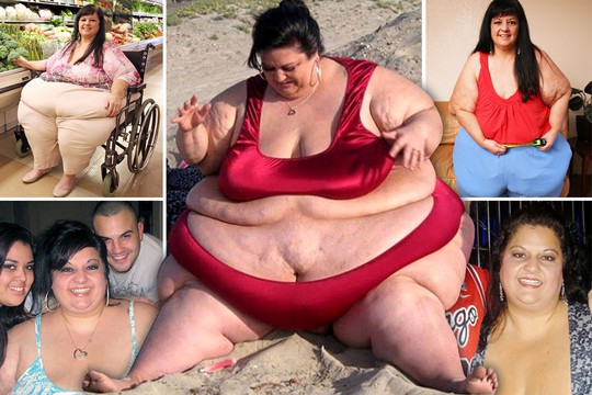 
Quá trình giảm béo của Patty Sanchez
